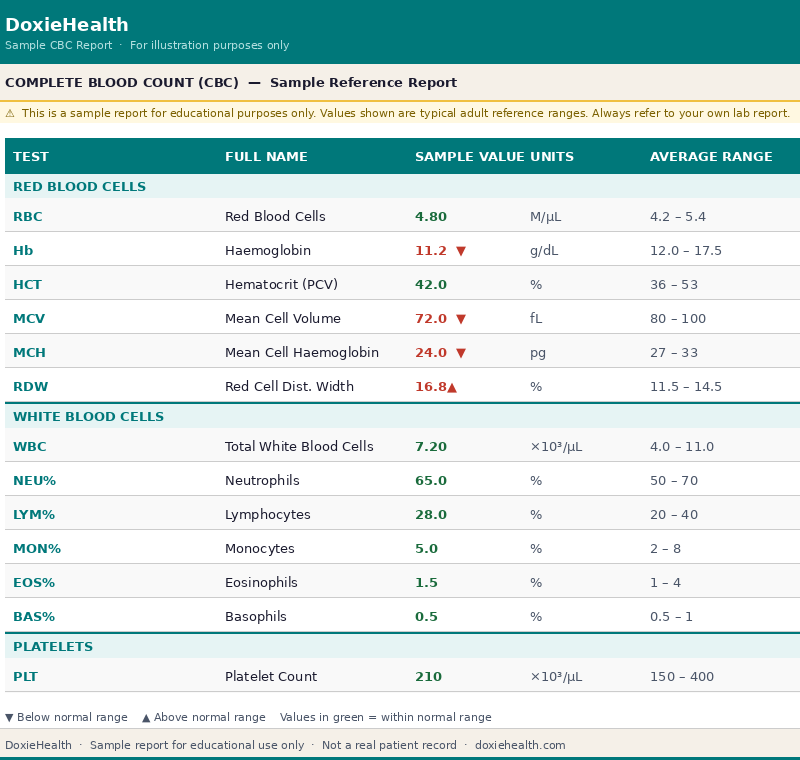 Sample CBC blood test report showing normal reference ranges