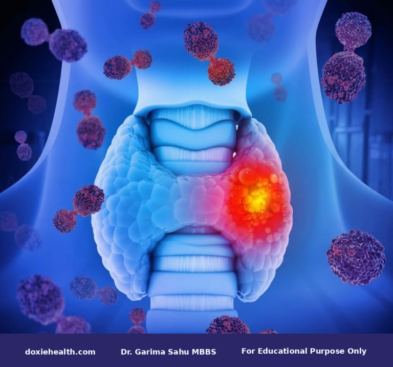 Thyroid Function Test TSH, T3 & T4